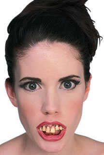 dentadura dientes podridos